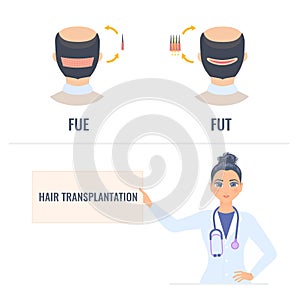 Hair transplantation infographics of male alopecia treatment