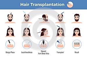 Hair Transplantation Men Women Infographics photo