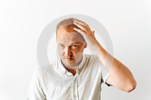 Before hair transplantation. Young sad bald man with depression at hair loss problems looking angry and frustrated and