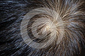 A hair whorl, on the human head, selected focus