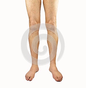 Hairy man legs