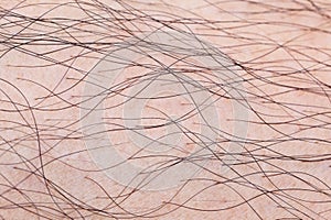 hairy skin texture for pattern