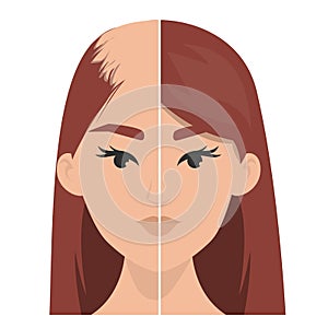 Hait transplantation before and after vector isolated