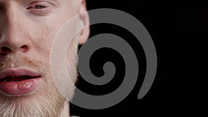 Half-Face Portrait Of Albino Guy Crying Posing On Black Background