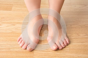 Hallux valgus, bunion in foot, pain in the legs