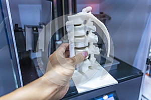 hand with 3d printed human spine