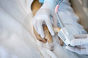 Hand of an asian patient in a severe coma with an attached pulse oximeter on fingertip,nurse measuring heart rate,checking oxygen photo