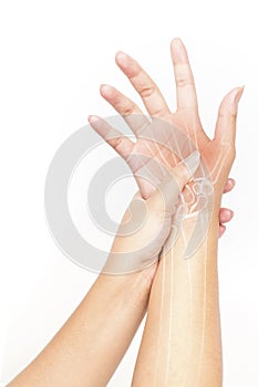 Hand bones injury