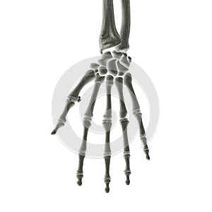 Hand Bones X-ray