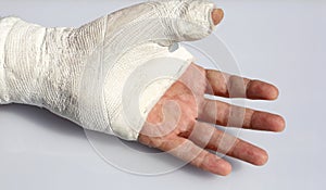 hand with chalk put by the hospital after the serious injury