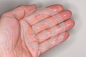 Fingers and palm covered with hand gel sanitiser. photo