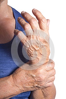 Hand Deformed From Rheumatoid Arthritis photo