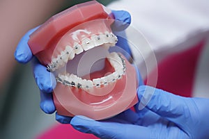 In hand on dentist orthodontics braces