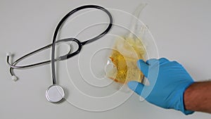 Hand of a doctor in blue glove placing a catheter drainage bag containing urine on a hospital table next to a stethoscope