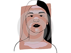 Hand-draw outline portrait of a young  woman with vitiligo  and dark beige sample color