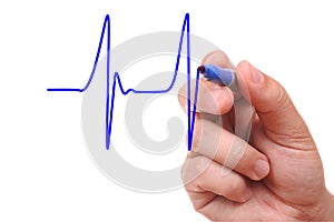 Hand drawing ecg graph