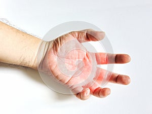 Hand and fingers tendinitis ,office syndrome photo