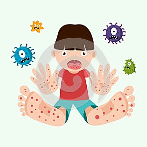 Hand foot mouth disease concept. child infected enterovirus