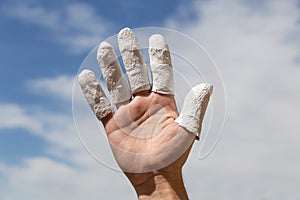 Hand in front of blue sky, injured finger