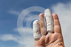 Hand in front of blue sky, injured finger