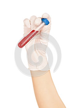 Hand holding blood in test tube