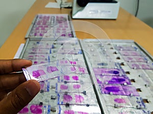 Hand holding histopathology slides stained with leishman stain, displayed and ready for microscopy photo