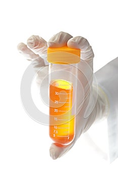 Hand holding liquid sample - urine photo