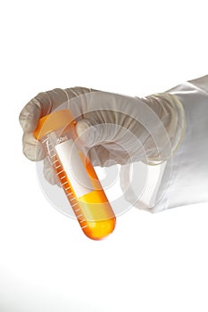 Hand holding liquid sample - urine photo