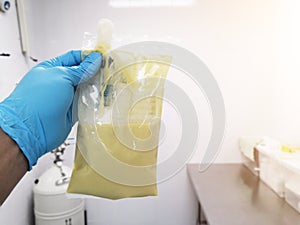 Hand Holding a Nutrient Bag at Nutrition department in hospital.Liquid food in the bag for severe paralyze patient. Liquid feed to