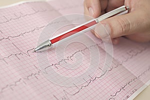 Hand holding pen indicates beats in ECG