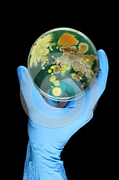 Hand holding petri dish growing bacteria