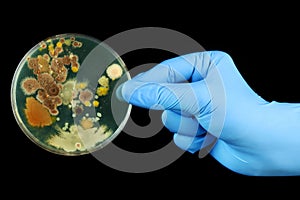 Hand holding petri dish growing bacteria