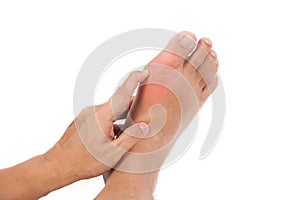 Hand holding Swollen Gout Inflamed Foot photo