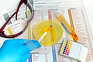 Hand holding test ph of sample urine on petri dish and analysis