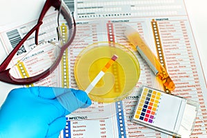 Hand holding test ph of sample urine on petri dish and analysis photo