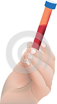 Hand holding test tube of blood for analysis