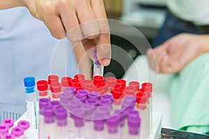 hand holding tube with collection blood samples in laboratory at