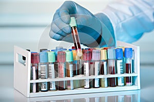 Hand holding tube of rack with blood test tubes in clinical lab