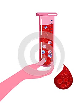 Hand holds laboratory test tube or beaker with sick cells.World Hemophilia Day concept. photo