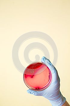 Hand holds Petri dish with Staphylococcus bacteria