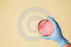 Hand holds Petri dish with Staphylococcus bacteria photo