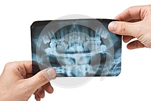 Hand holds radiograph