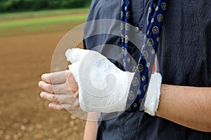 Hand of the injured person after the fracture of the bone photo