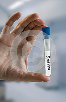 Hand of ivf doctor in sperm bank holds test tube with sperm samp photo