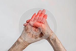 Hand joints inflammation. Concept of rheumatic arthritis, rheumatism, gout, joint swelling or arthralgia photo
