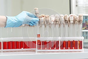 Hand of a lab technician holding blood tube test and background a rack of tubes with blood samples other patients