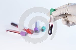 Hand of laboratory technician holding test tube with blood.