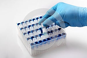 Hand of a laboratory technician holding a tube with a biological sample for cryogenic storage