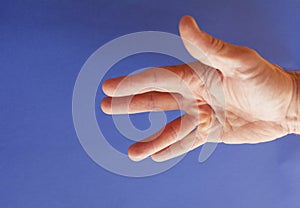 Hand of an man with Dupuytren contracture on blue