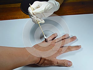 Hand in medical rubber glove apply some remedy to wound